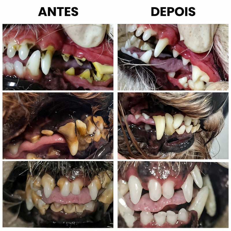 Gel Reparador Oral | Clareamento e Remoção de Tártaro